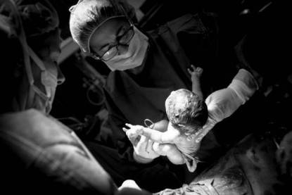 dottore aiuta bimbo a nascere