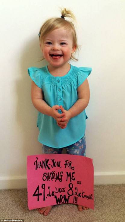 bambina con la Sindrome di Down