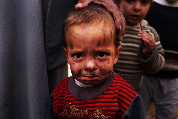 bambini vittime delle guerra