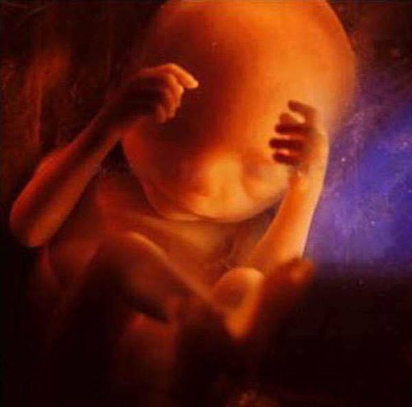 feto 24 settimane 