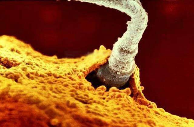 spermatozoo dentro ovulo