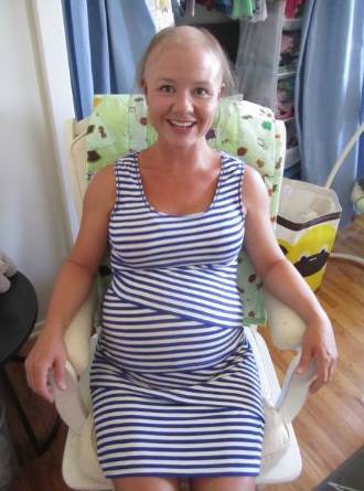 alopecia in gravidanza