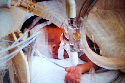 neonato morto torna in vita