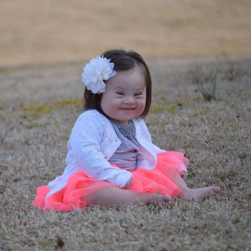 emmy bambina con la sindrome di down 2