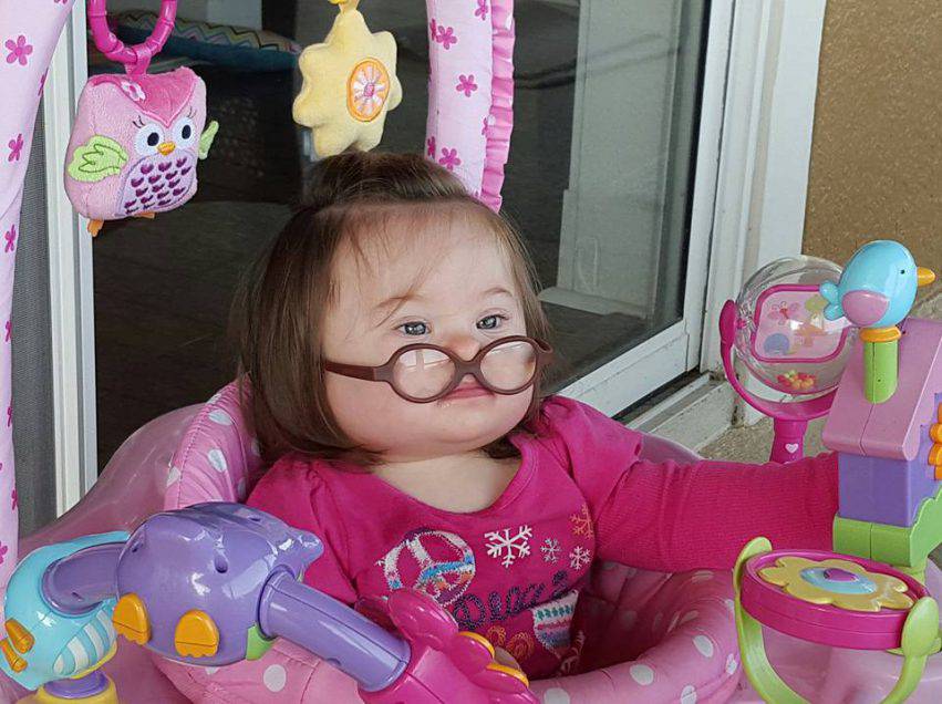 emmy bambina con la sindrome di down 3