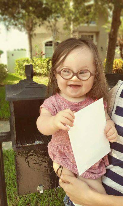 bambina con la sindrome di down