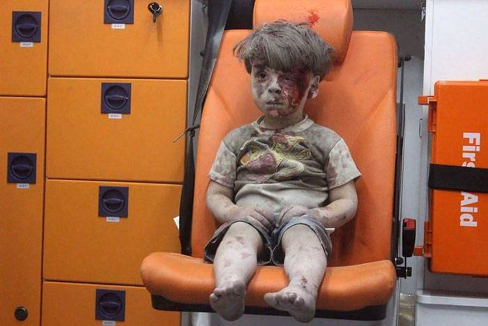 bambino siriano ferito