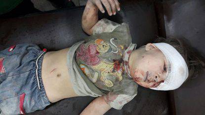bambino siriano ferito