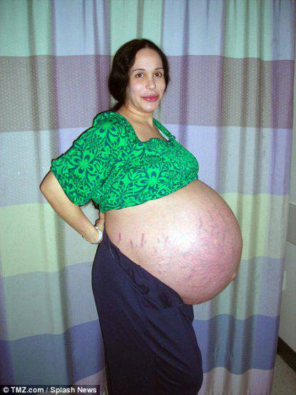3820313300000578-3781725-suleman_hit_the_headlines_in_2009_when_pictures_of_her_pregnant_-a-26_1473696920998