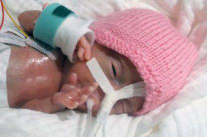 pay-smallest-ever-prem-baby-to-survive-was-only-31-cm-long