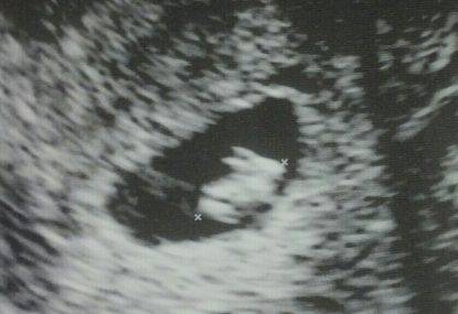 coniglio nell'ecografia dettaglio