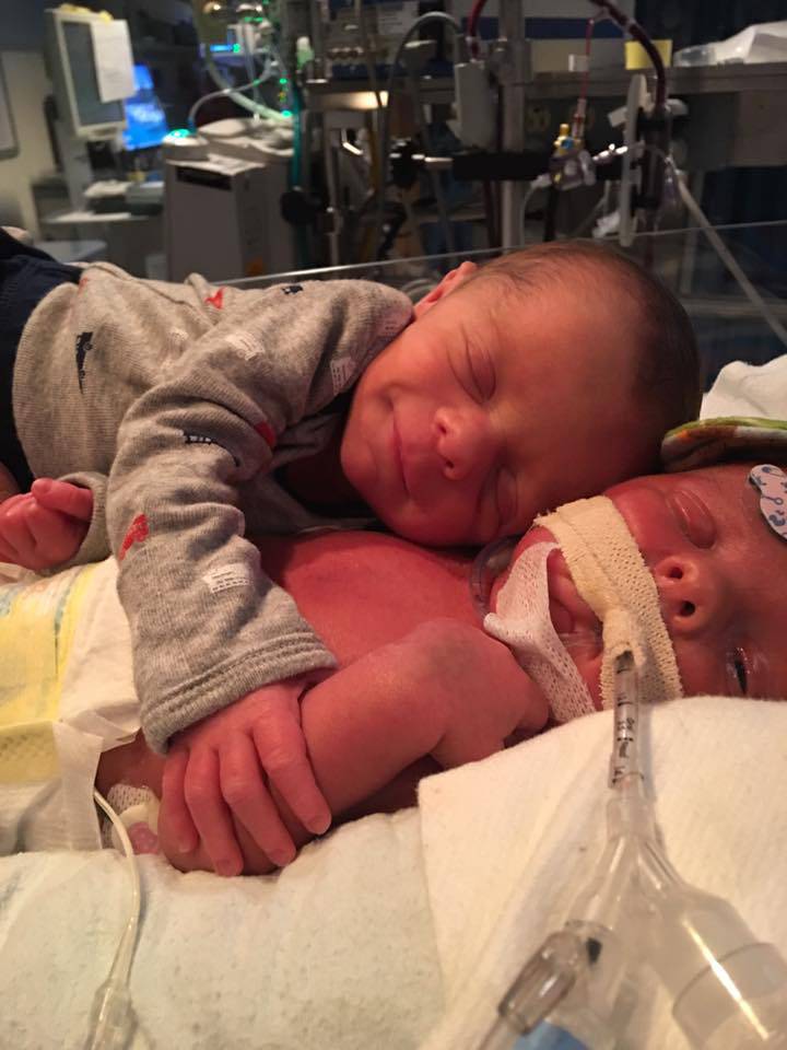 neonato abbraccia gemello malato