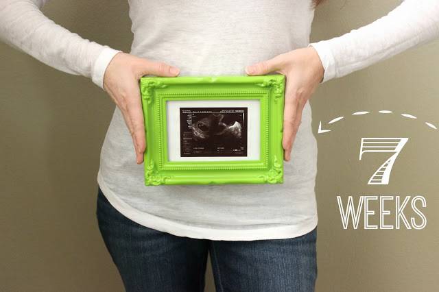 7-weeks-pregnant-photo-nicole-mendez-manor