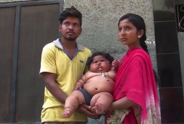neonata obesa
