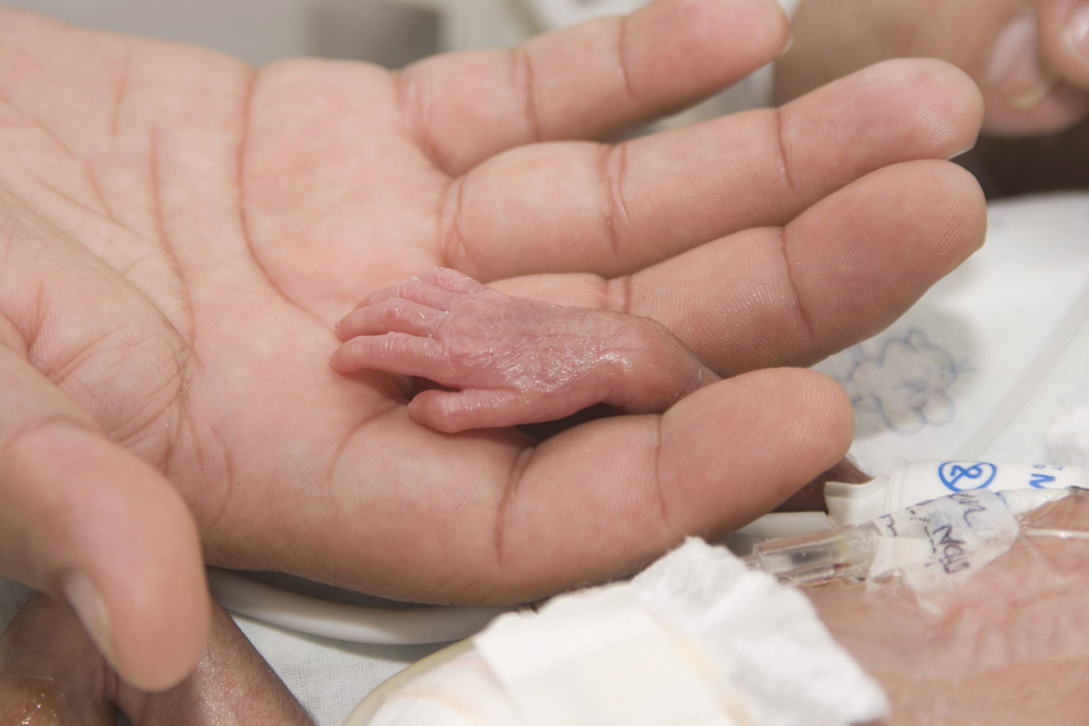 Mano di un bambino prematuro