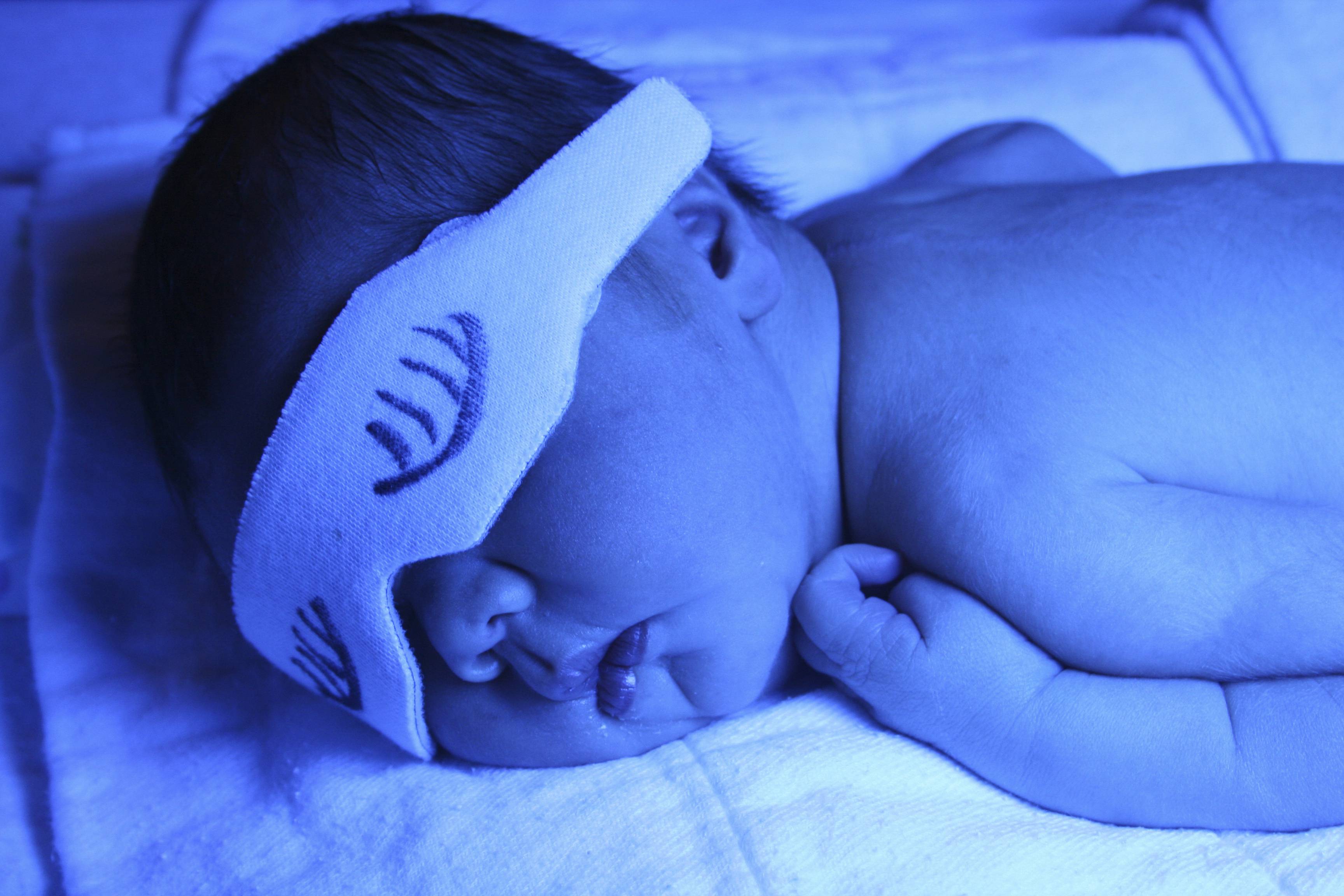 Желтушка у новорожденных дома. Желтушка у новорожденных фототерапия. Лампа для желтушка у новорожденных. Очки для фототерапии новорожденных. Лампа для фототерапии.