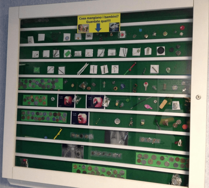 Gli oggetti ingeriti più spesso dai bimbi