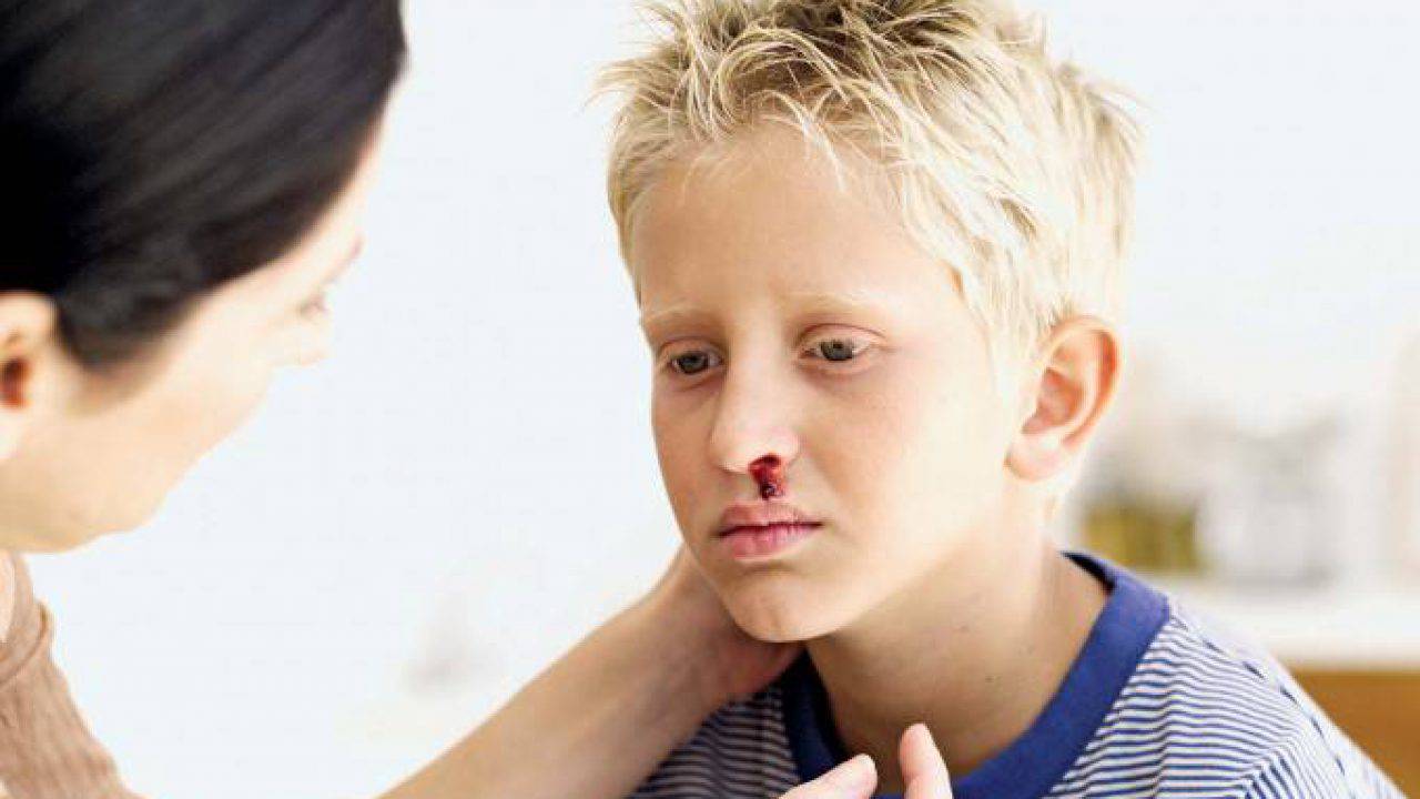 come smettere di perdere sangue dal naso