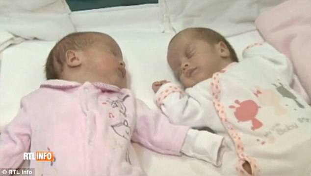 L'incredibile storia di due gemelle: vengono alla luce a distanza di due mesi(FOTO)
