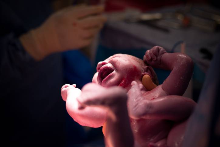 bambino nato con parto cesareo