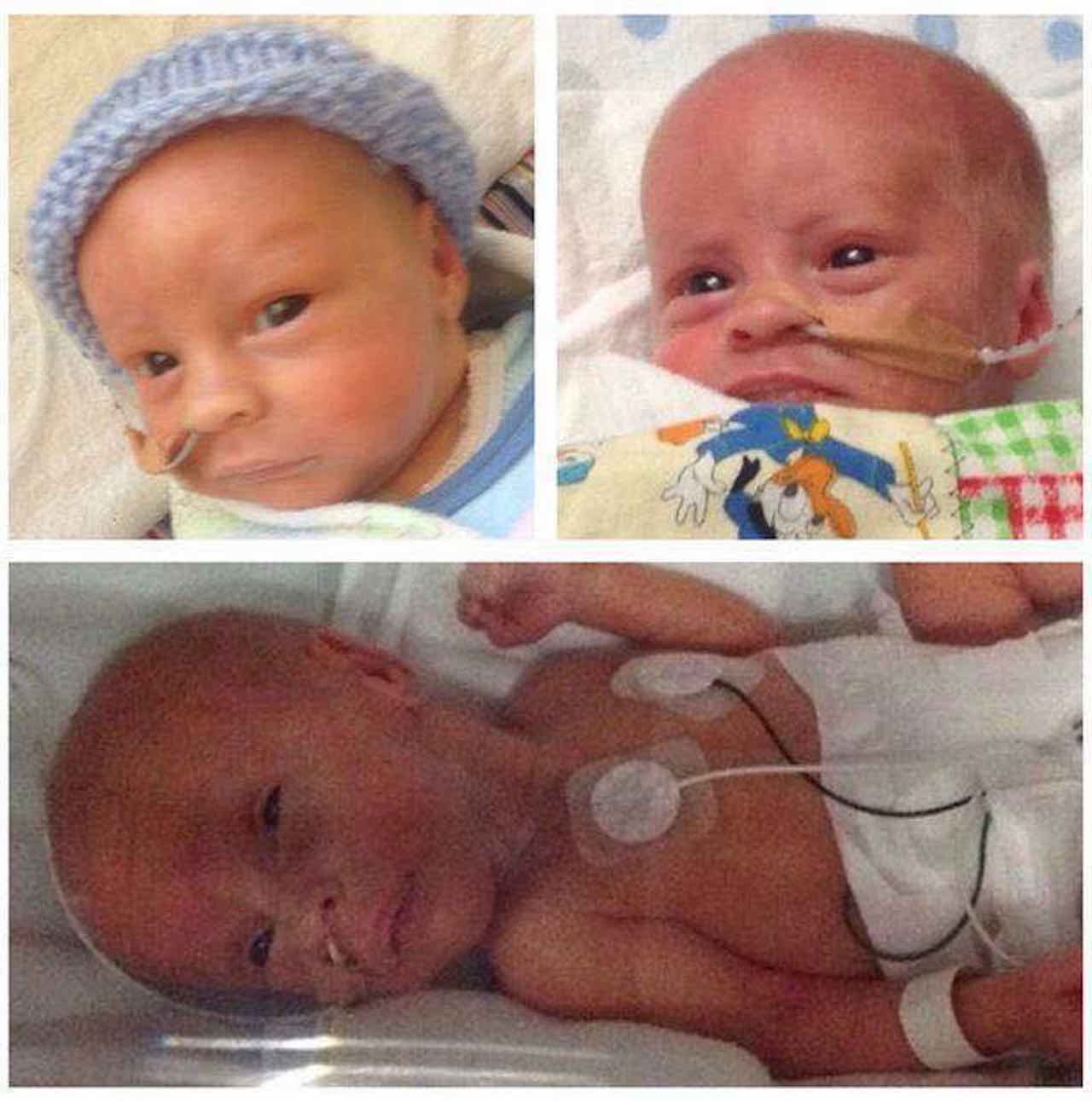 tre gemelli una placenta