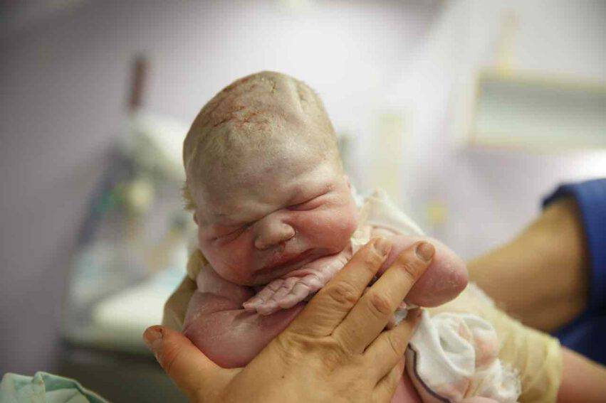 neonato dopo  il parto