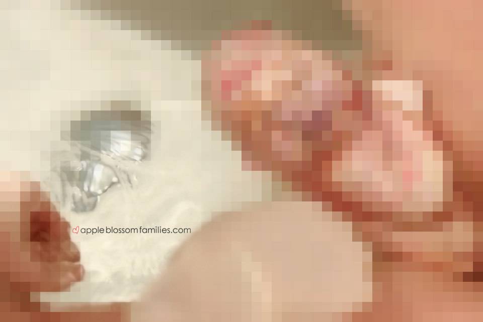 bambino nel sacco amniotico