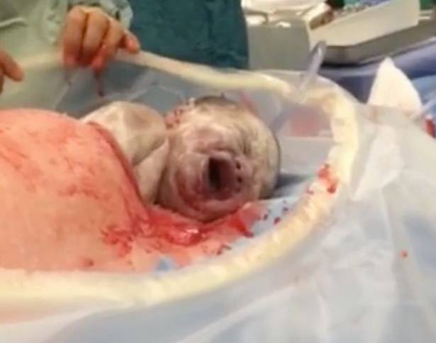 neonato esce da solo