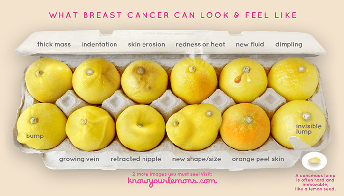 prevenzione del cancro al seno