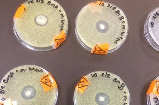 latte materno e batteri