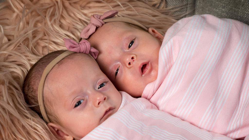 gemelline sopravvissute