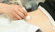 miti sull'aborto spontaneo