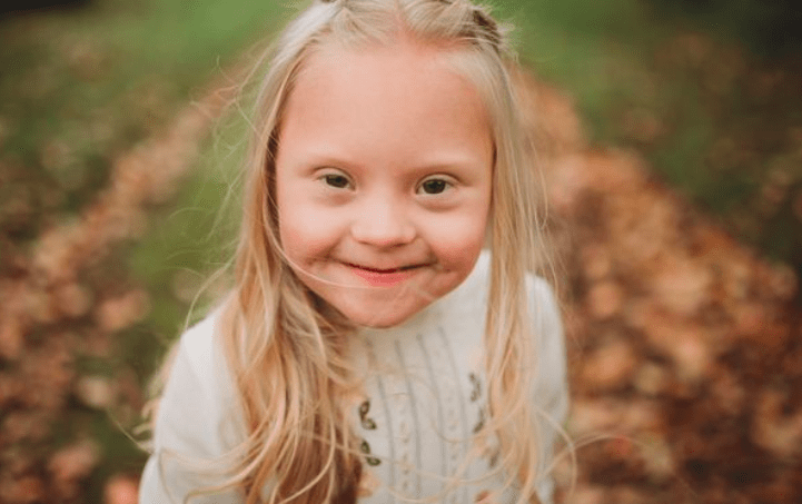 bambina sindrome di down testimonial brand