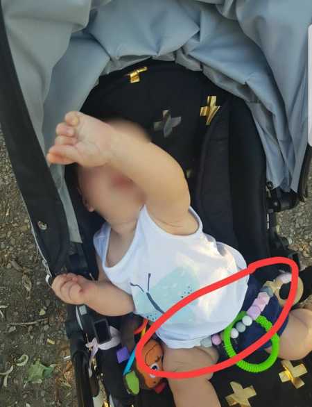 rischio di soffocamento collana denti 