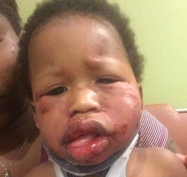 imbo di 1 anno è stato picchiato