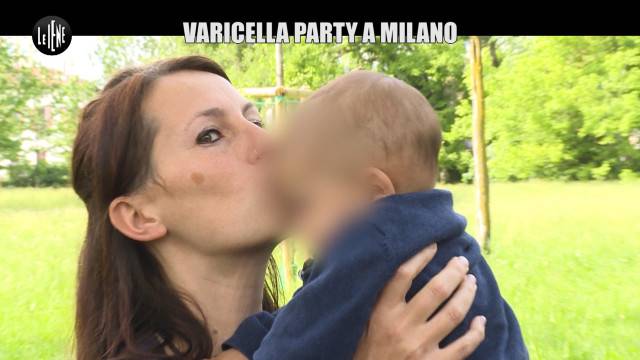 Varicella Party