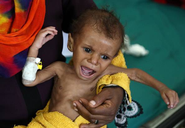 in yemen 85.000 bambini morti per fame
