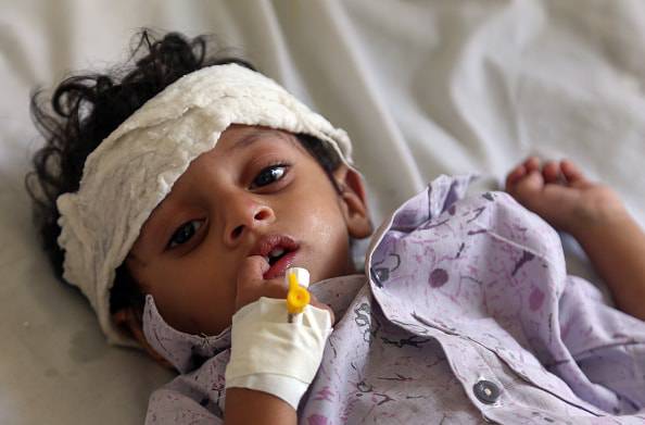 bambini morti in yemen