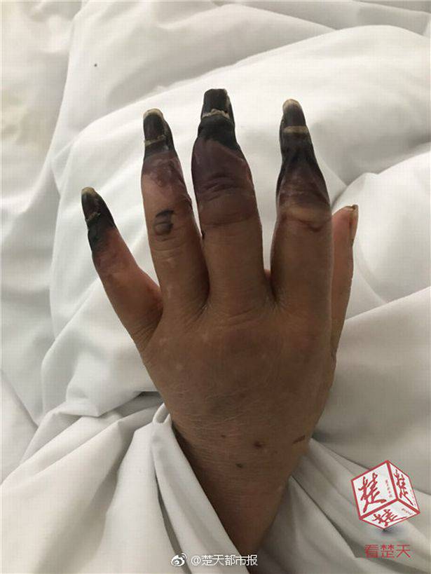 donna dita nere