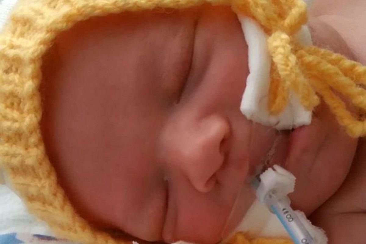 bambino morto dopo parto difficile