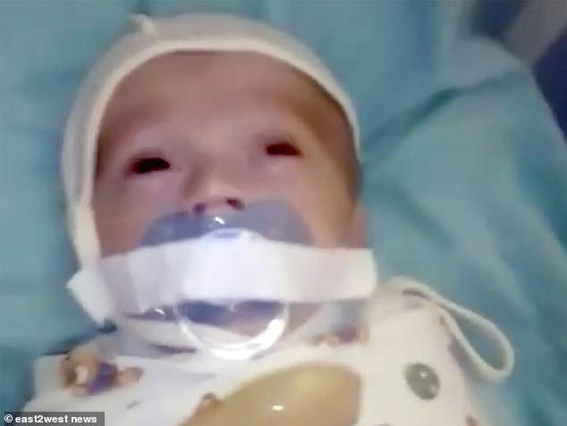 bambino con ciuccio legato alla bocca