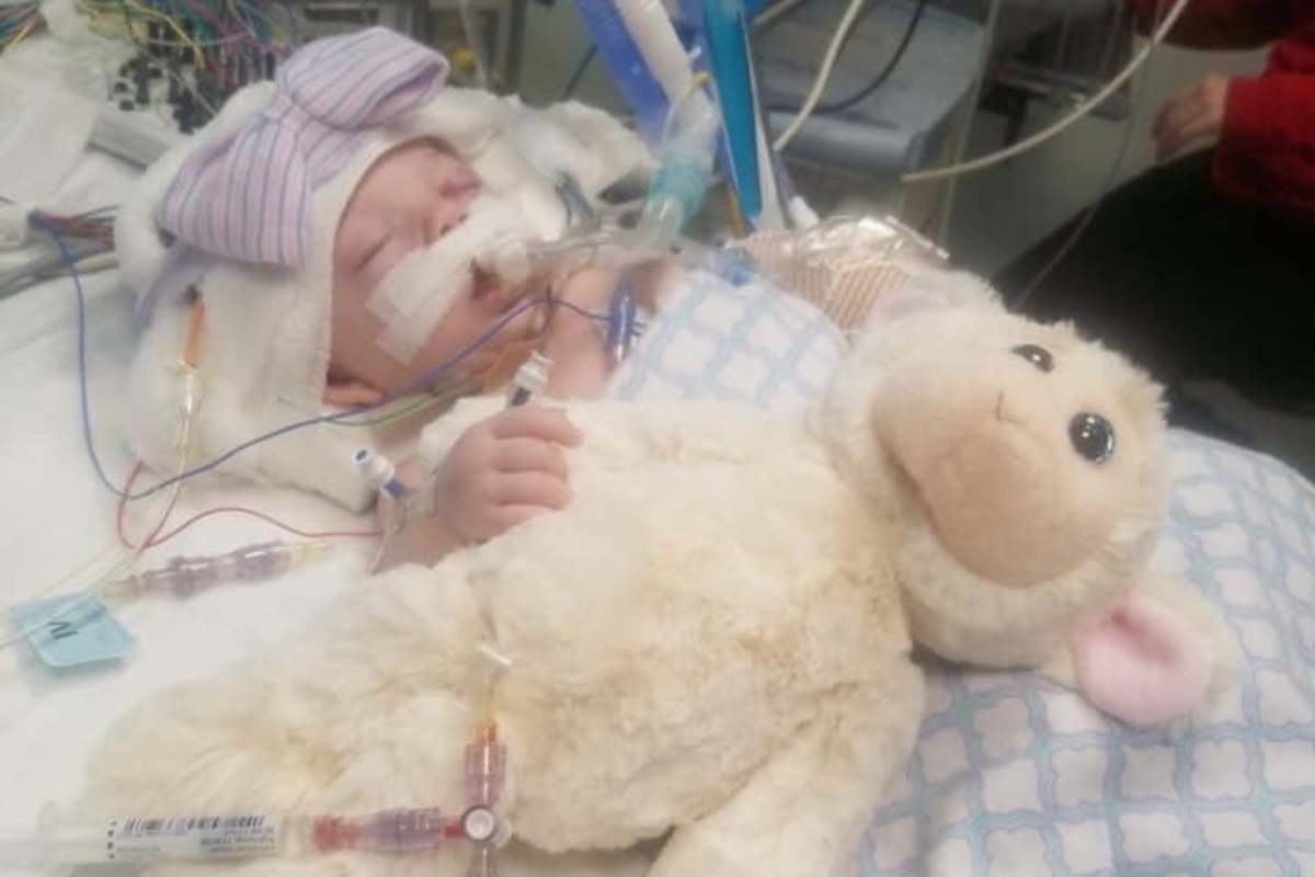 bambina di 3 mesi in coma