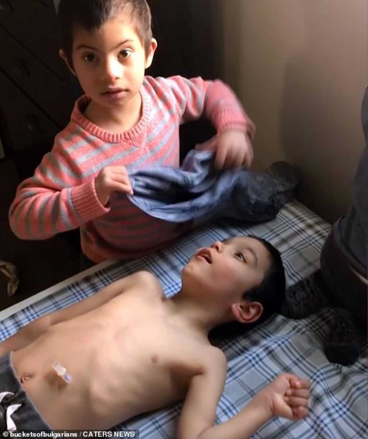 bambino sindrome down aiuta fratellini