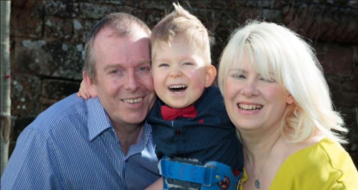 bambino nato senza cervello