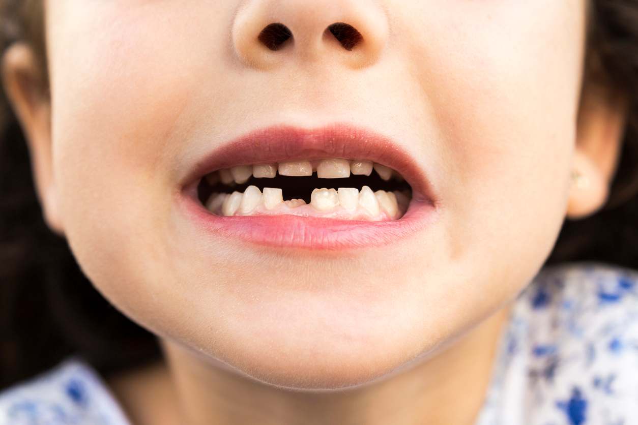 denti e malattie mentali