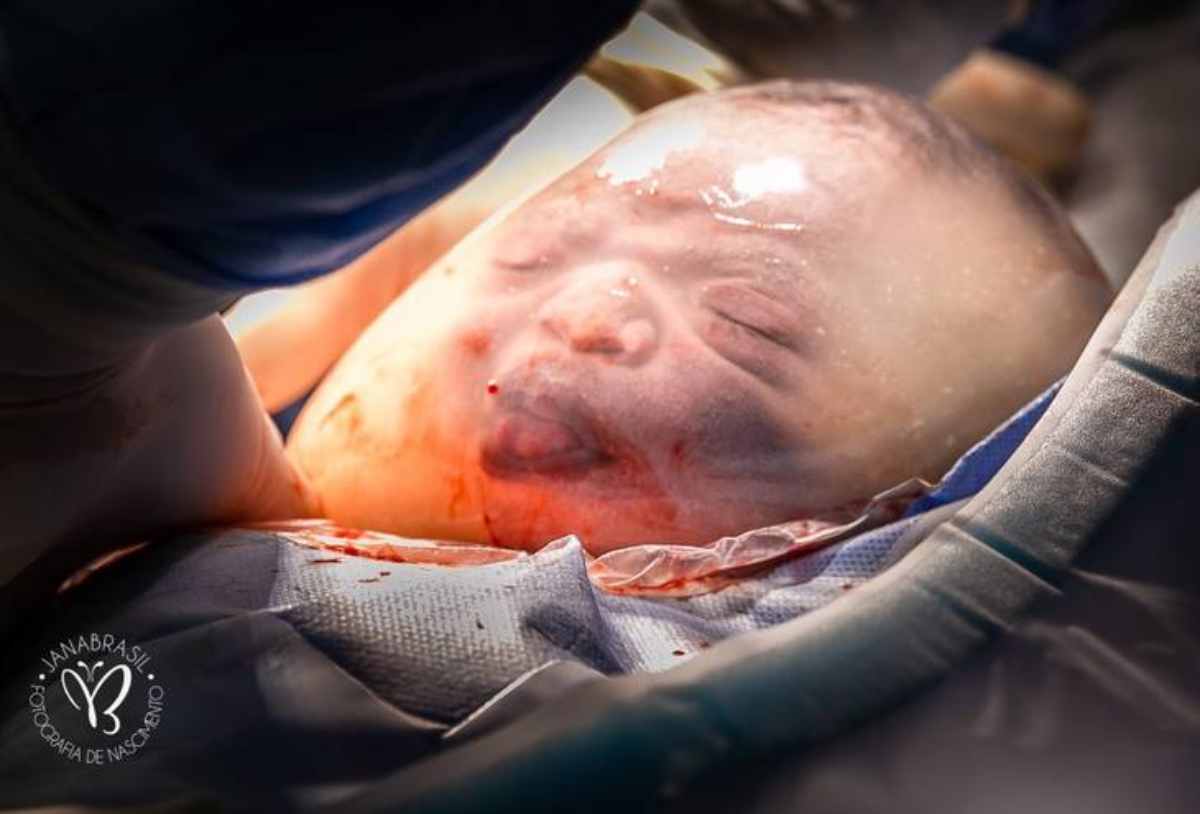bambino nato nel sacco amniotico 1