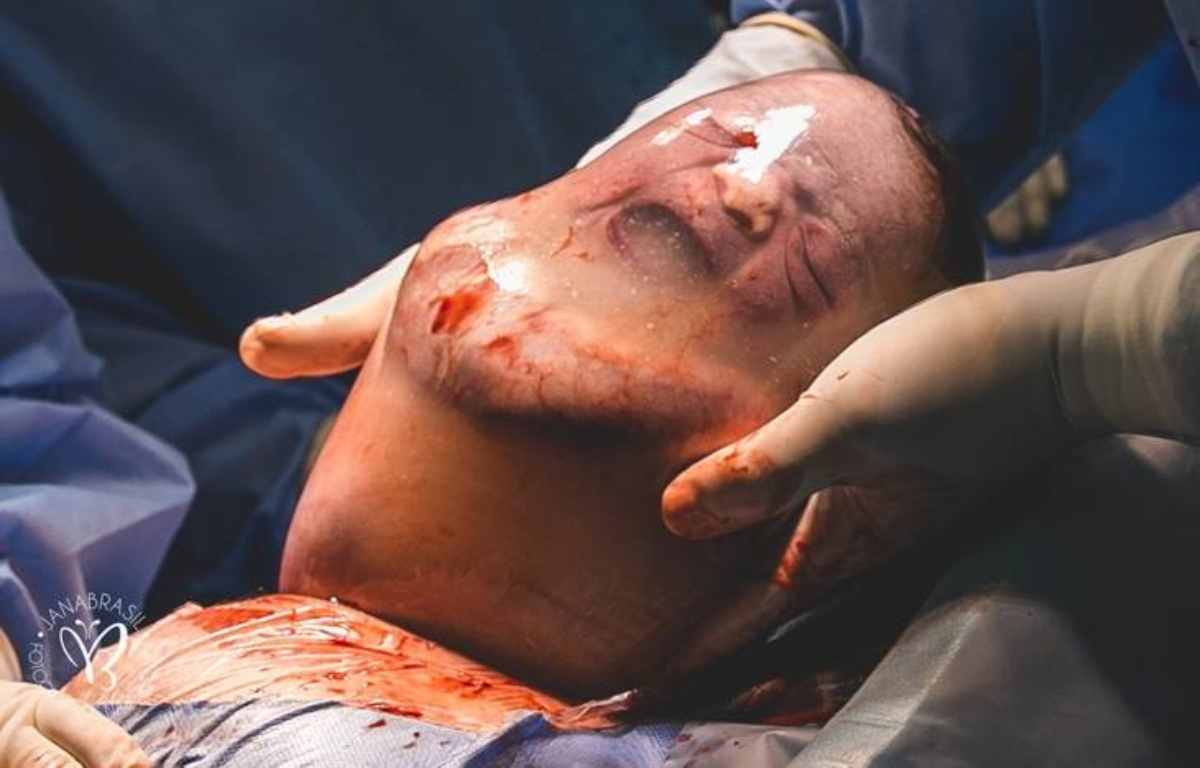 bambino nato nel sacco amniotico 3