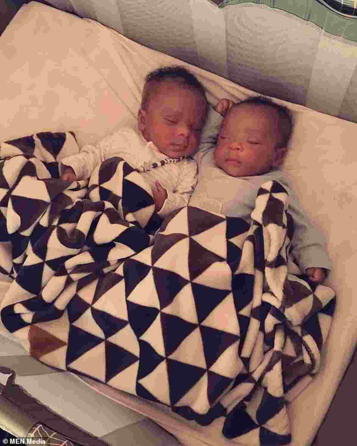 gemelli con leucemia  2