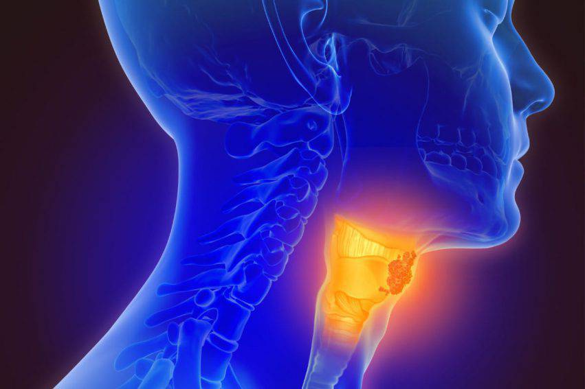virus hpv e tumore alla gola pastile pentru paraziți intestinali