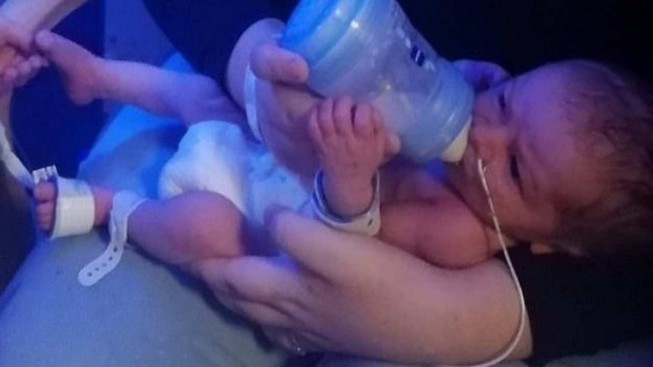 acque rotte partorisce dopo 10 settimane